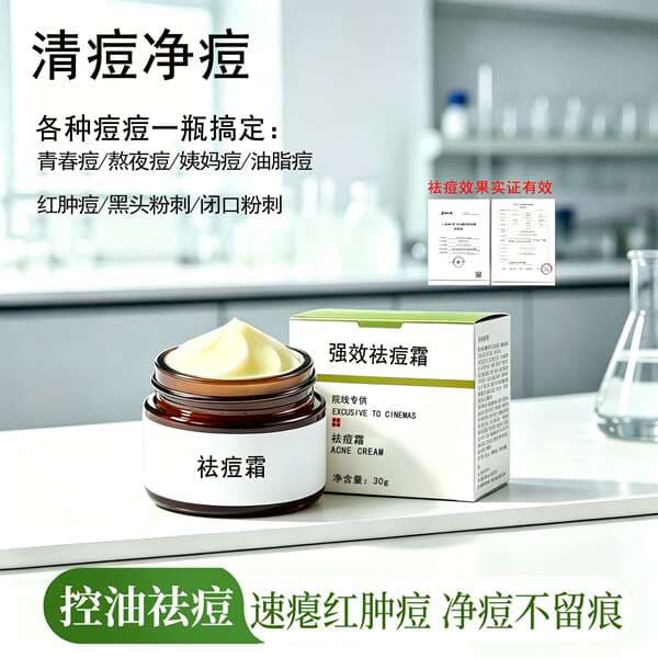 Beauty Salons Specialize in Anti-Acne Cream to Remove Acne, Closed Comedones, and Pimples, with Strong Oil Control, Leaves No Marks, and No Need for Needle Removal