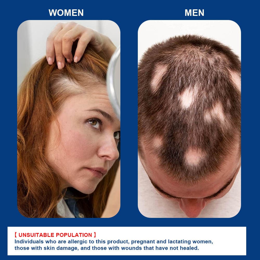 Sumifun Sophora Flavescens Alopecia Areata Ointment, Head Skin and Scalp Care Cream, Cross-Border Hair Growth and Maintenance Ointment 4