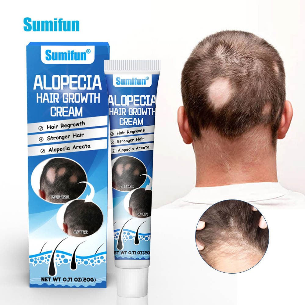 Sumifun Sophora Flavescens Alopecia Areata Ointment, Head Skin and Scalp Care Cream, Cross-Border Hair Growth and Maintenance Ointment 1